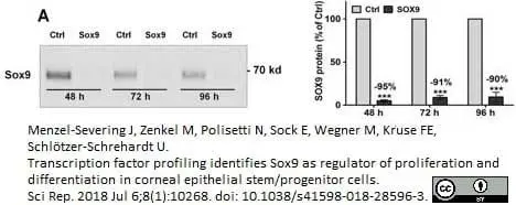 Anti Human SOX9 Antibody, clone 3C10 gallery image 11