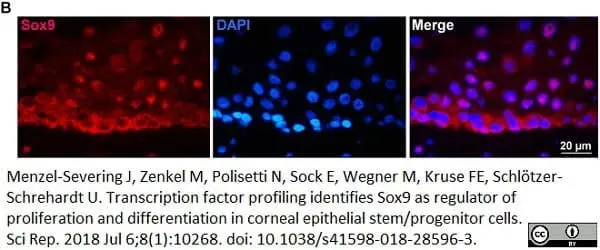Anti Human SOX9 Antibody, clone 3C10 gallery image 5