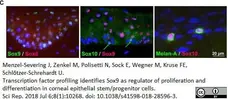 Anti Human SOX9 Antibody, clone 3C10 gallery image 6