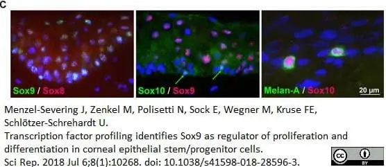Anti Human SOX9 Antibody, clone 3C10 gallery image 6