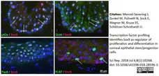 Anti Human SOX9 Antibody, clone 3C10 gallery image 7