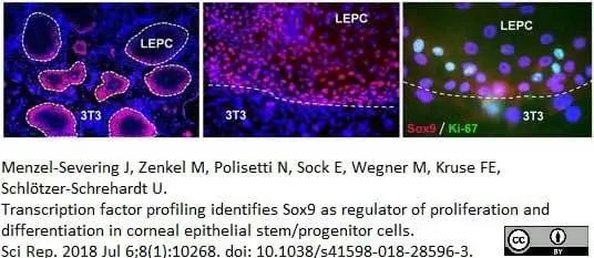 Anti Human SOX9 Antibody, clone 3C10 gallery image 8