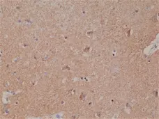 Anti Spastin Antibody, clone RM346 gallery image 2