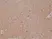 Anti Spastin Antibody, clone RM346 thumbnail image 2