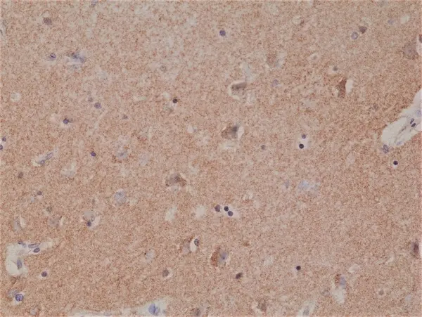 Anti Spastin Antibody, clone RM346 gallery image 2