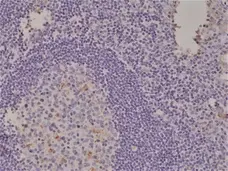 Anti Spastin Antibody, clone RM346 gallery image 3