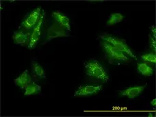 Anti Human SQSTM1 Antibody, clone 2C11 gallery image 1
