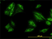 Anti Human SQSTM1 Antibody, clone 2C11 thumbnail image 1
