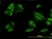 Anti Human SQSTM1 Antibody, clone 2C11 thumbnail image 1