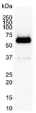 Anti Human SQSTM1 Antibody, clone 2C11 thumbnail image 2