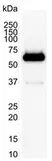 Anti Human SQSTM1 Antibody, clone 2C11 thumbnail image 2