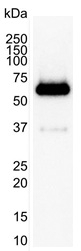 Anti Human SQSTM1 Antibody, clone 2C11 gallery image 2