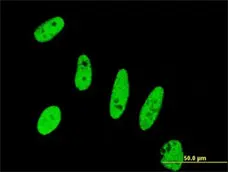 Anti Human Survivin Antibody, clone 5B10 gallery image 1