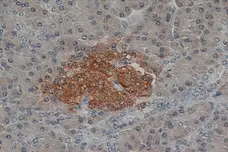 Anti Human Synaptophysin Antibody, clone SP15 gallery image 1