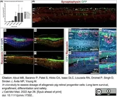 Anti Human Synaptophysin Antibody, clone SP15 gallery image 2
