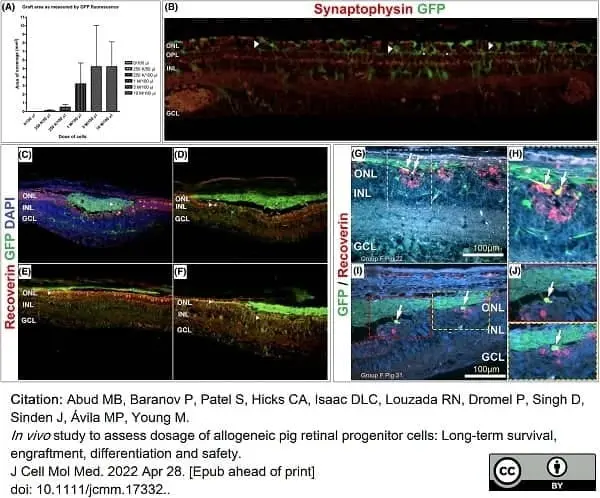 Anti Human Synaptophysin Antibody, clone SP15 gallery image 2