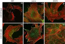 Anti Human Talin-1 Antibody, clone 97H6 gallery image 2