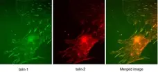 Anti Human Talin-1 Antibody, clone 97H6 gallery image 3