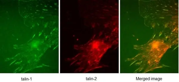Anti Human Talin-1 Antibody, clone 97H6 gallery image 3