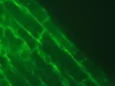 Anti Human Talin-2 Antibody, clone 53.8 gallery image 3