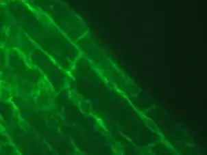 Anti Human Talin-2 Antibody, clone 53.8 gallery image 3