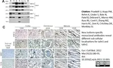 Anti Human Talin-2 Antibody, clone 53.8 gallery image 6