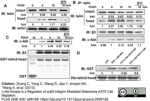 Anti Human Talin Antibody, clone TA205 gallery image 2