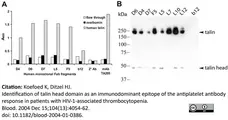 Anti Human Talin Antibody, clone TA205 gallery image 5