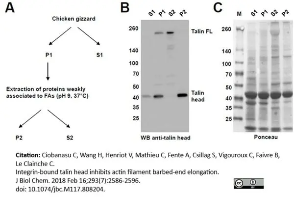 Anti Human Talin Antibody, clone TA205 gallery image 6