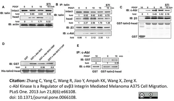 Anti Human Talin Antibody, clone TA205 gallery image 7