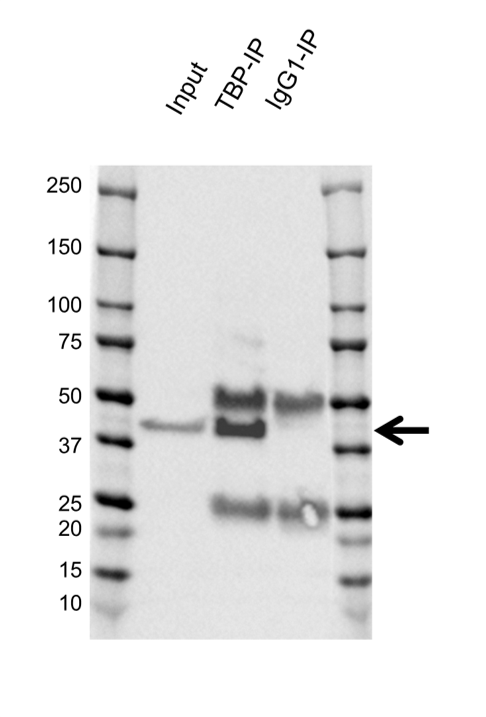 Anti TATA-BOX-BINDING Protein Antibody, clone 830CT4.3.3 (PrecisionAb Monoclonal Antibody) gallery image 4