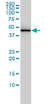Anti Human TDP43 Antibody, clone 2E2-D3 thumbnail image 1