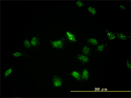 Anti Human TFEB Antibody, clone 3E1-G6 gallery image 1