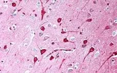 Anti Human TGF Beta Antibody, clone TB21 gallery image 1
