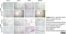 Anti Human TGF Beta Antibody, clone TB21 gallery image 2