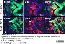 Anti Human TGF Beta Antibody, clone TB21 gallery image 3