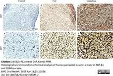 Anti Human TGF Beta Antibody, clone TB21 gallery image 5