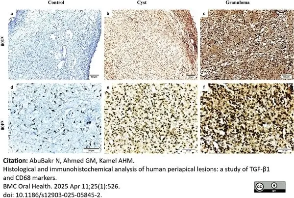 Anti Human TGF Beta Antibody, clone TB21 gallery image 5