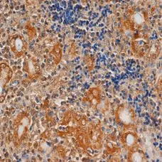 Anti Human Thyroid Stimulating Hormone Receptor Antibody, clone 4C1 gallery image 1