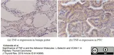 Anti Human TNF Alpha Antibody, clone MP9-20A4 gallery image 3