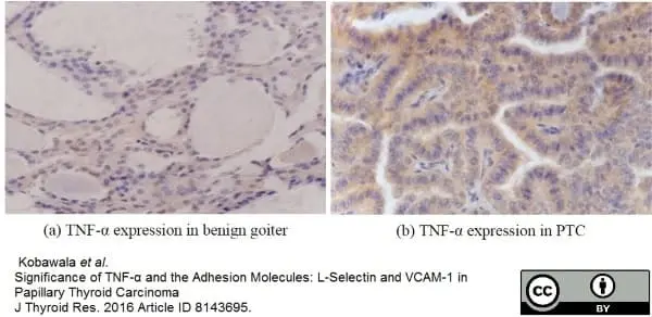 Anti Human TNF Alpha Antibody, clone MP9-20A4 gallery image 3