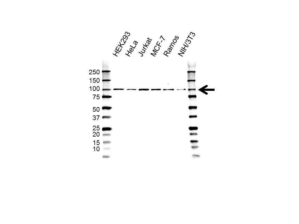 Anti TOP1 Antibody (PrecisionAb Monoclonal Antibody) gallery image 1