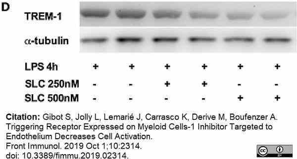 Anti Human Trem-1 Antibody, clone TREM-37 gallery image 1