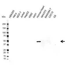 Anti Troponin T (Cardiac) Antibody, clone C03-9H8 (PrecisionAb Monoclonal Antibody) gallery image 1