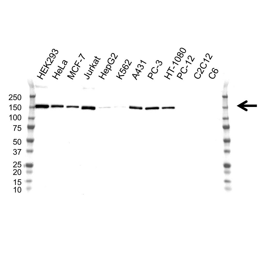 Anti TSC1 Antibody, clone OTI3A2 (PrecisionAb Monoclonal Antibody) gallery image 1