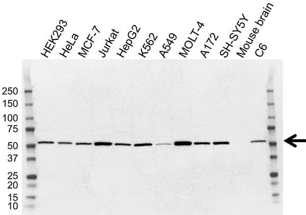 Anti Tubulin Alpha 1A Chain Antibody, clone OTI2C8 (PrecisionAb Monoclonal Antibody) gallery image 1