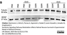 ANTI-TUBULIN hFAB™ Rhodamine Antibody Antibody, clone AbD22584 gallery image 14