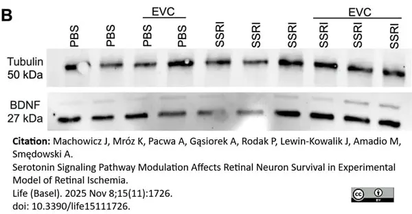 ANTI-TUBULIN hFAB™ Rhodamine Antibody Antibody, clone AbD22584 gallery image 14