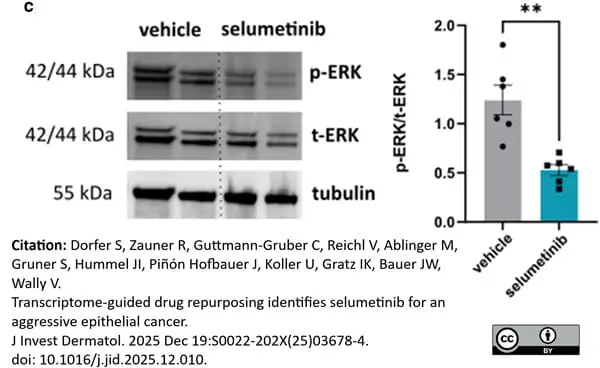 ANTI-TUBULIN hFAB™ Rhodamine Antibody Antibody, clone AbD22584 gallery image 16