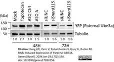 ANTI-TUBULIN hFAB™ Rhodamine Antibody Antibody, clone AbD22584 gallery image 17